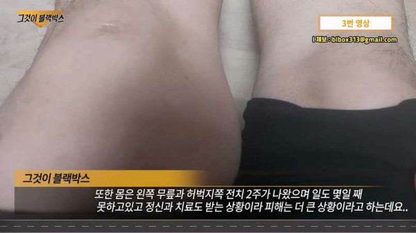 갑자기 지나가는 사람 골프채 풀 스윙하고 고소당한 학생